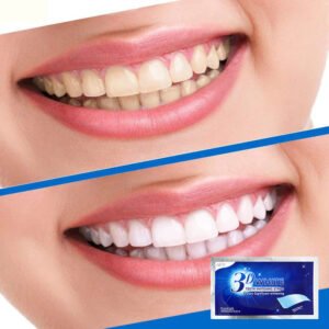 عرض 6 قطع (عرض 3 شيتات التبيض الأصلي 3D WHITE + عرض 3 شيتات التبيض الأصلي 3D WHITE )