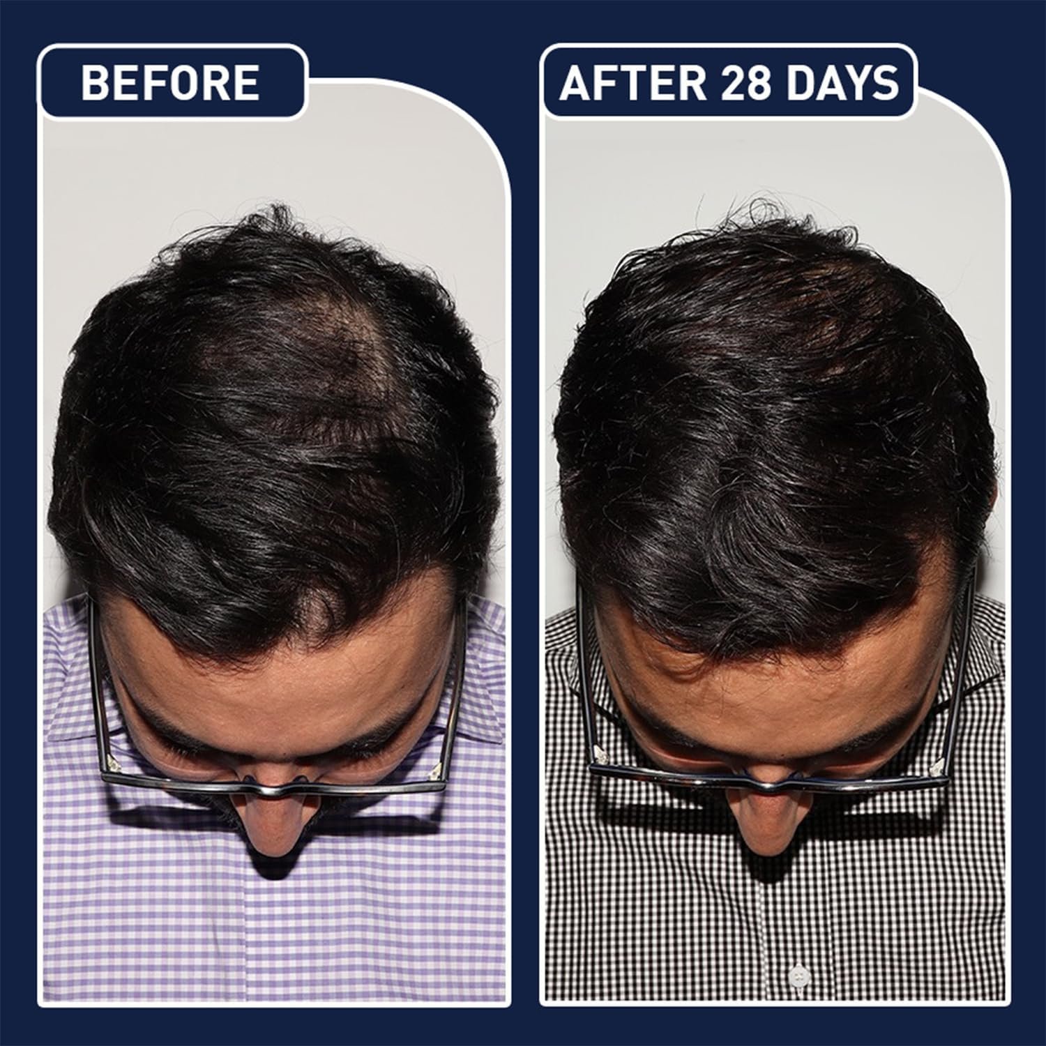 عرض سيرم Blue PePtide + سبراي الشعر FEG - Image 4