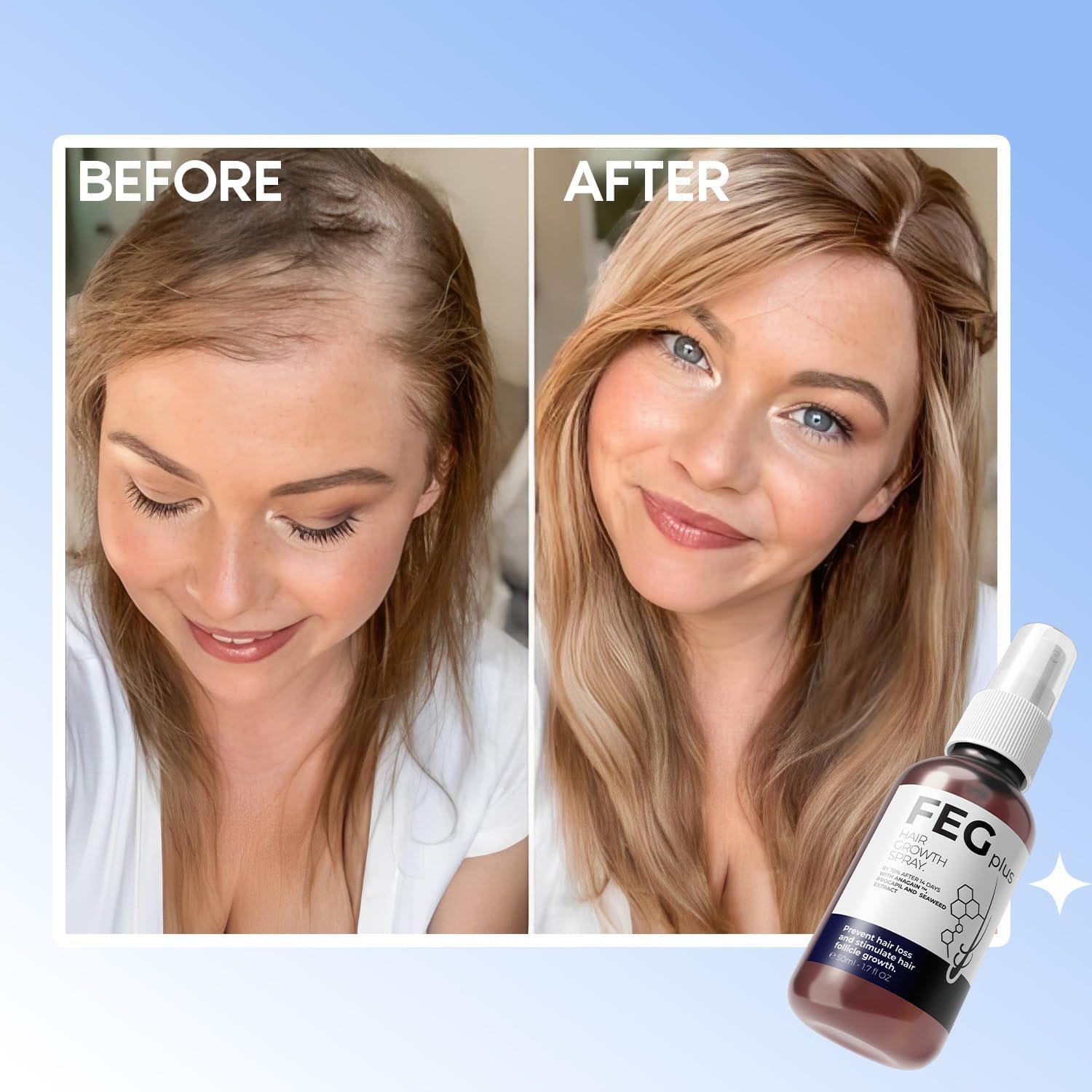 عرض سيرم Blue PePtide + سبراي الشعر FEG - Image 7
